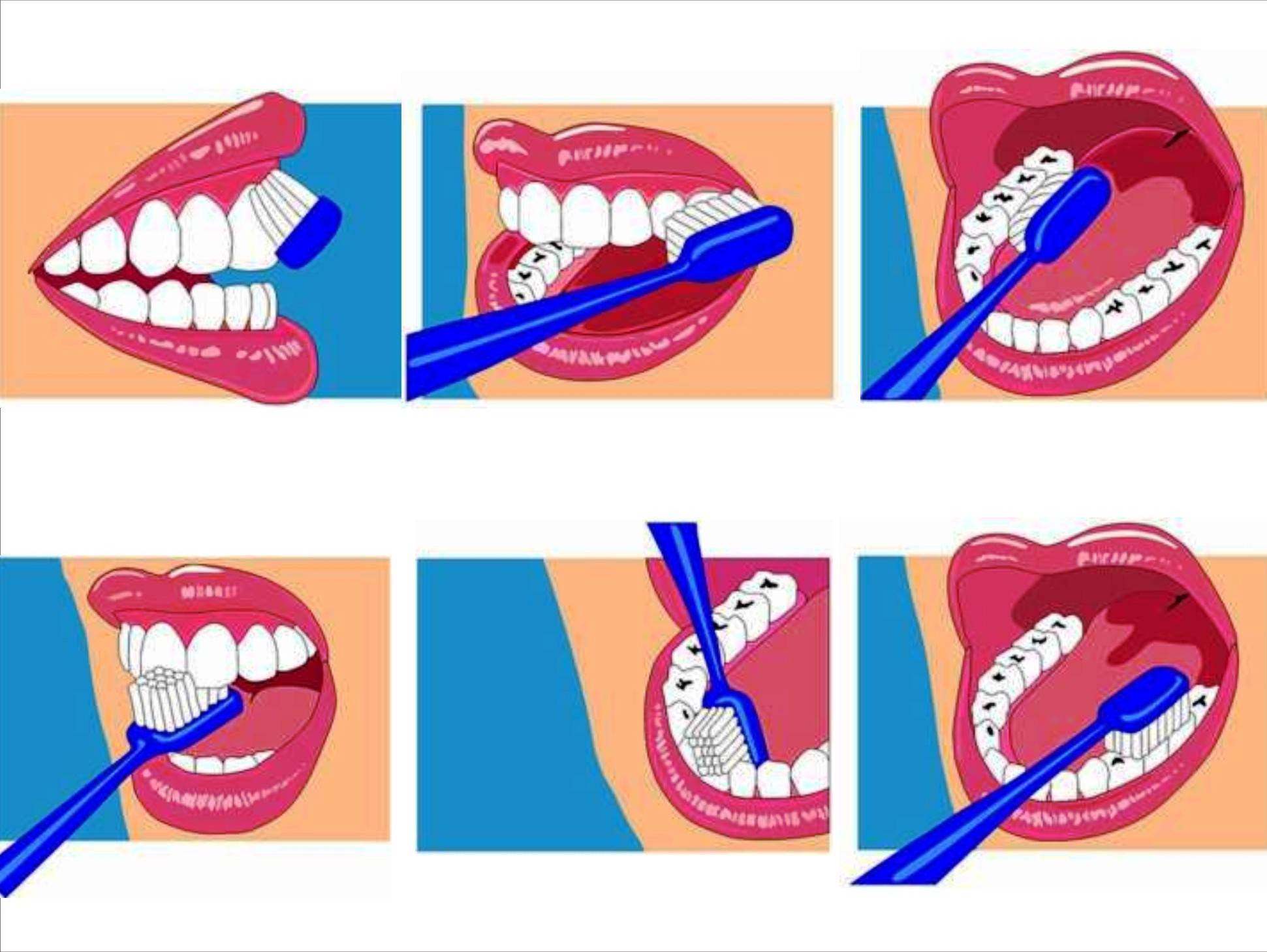 Сохранить зубы здоровыми - гигиена и правильное питание
